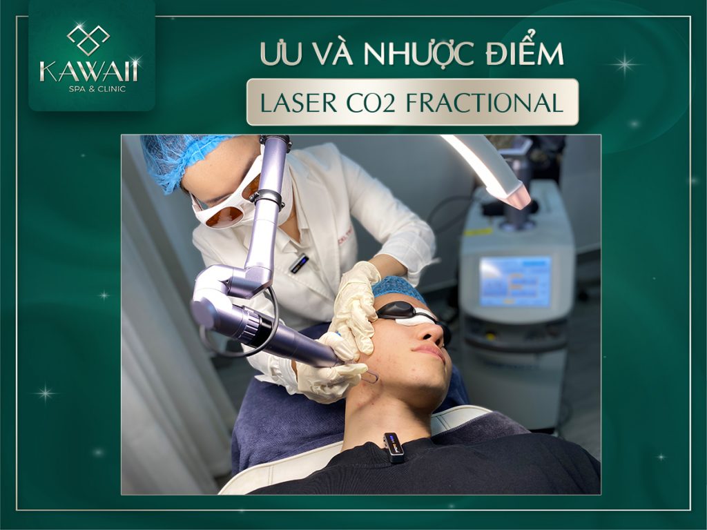 laser co2 fractional có tốt không