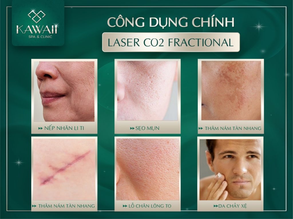 phương pháp fractional co2