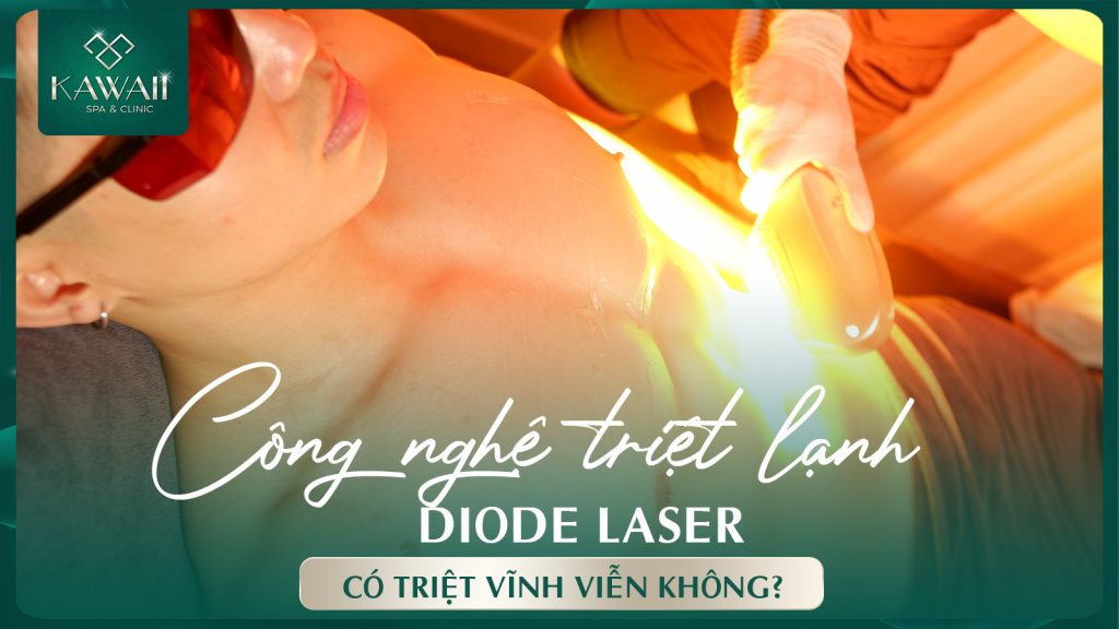 Diode laser la gì