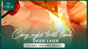 Diode laser la gì